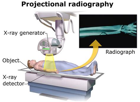 Image intensifiers and flat panels. File:Projectional radiography components.jpg - Wikimedia ...
