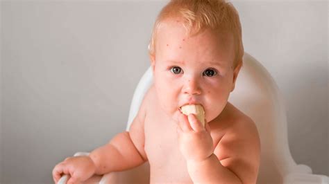 Alergia alimentar na infância como prevenir nos seus filhos