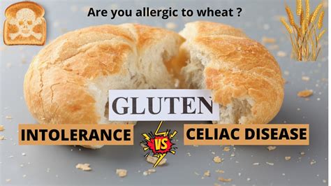 Gluten Intolerance Vs Celiac Disease Diet 8 Youtube