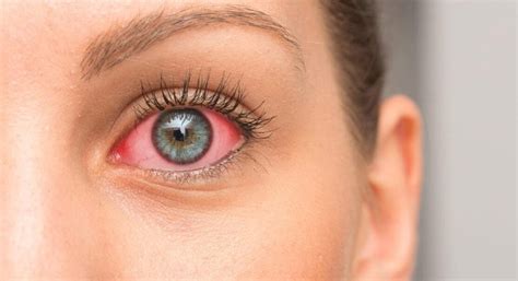 8 Common Causes Of Skin Irritation Around The Eyes Medical Device