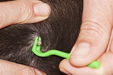 5 Things Dog Owners Should Know About Ticks Tick Removal Dog Ticks