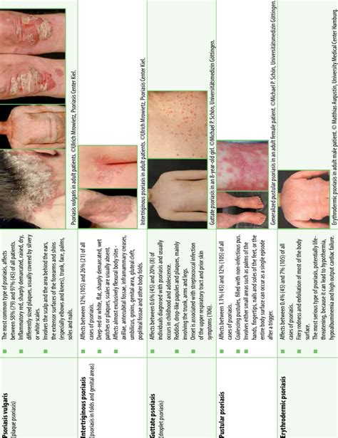 Common Types Of Psoriasis And Their Manifestations Download Scientific Diagram