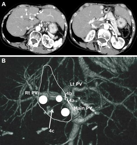 Contrast Enhanced Computed Tomography Ct Examination At The Fourth