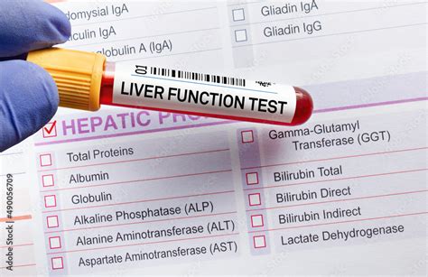 Blood Tube Test With Requisition Form For Liver Function Test Lft