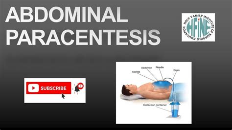 Abdominal Paracentesis Nursing Procedure Youtube