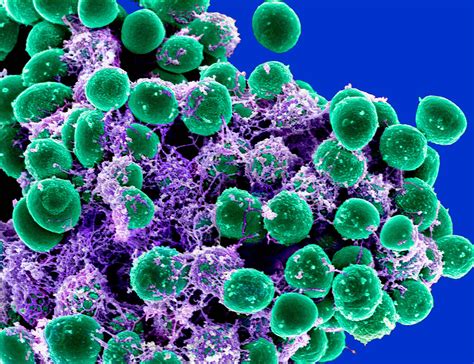 Preventing Bacterial Infections From Medical Devices National