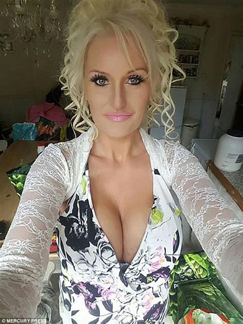 Cornwall Woman Loses Stone And Got Size G Breast Implants In Amazing