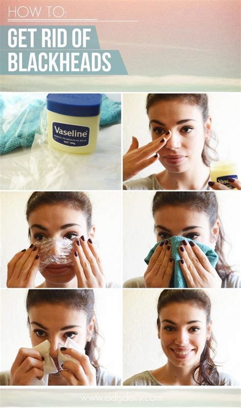 Homemade Blackheads Remover Tutorials And Ideas Hative