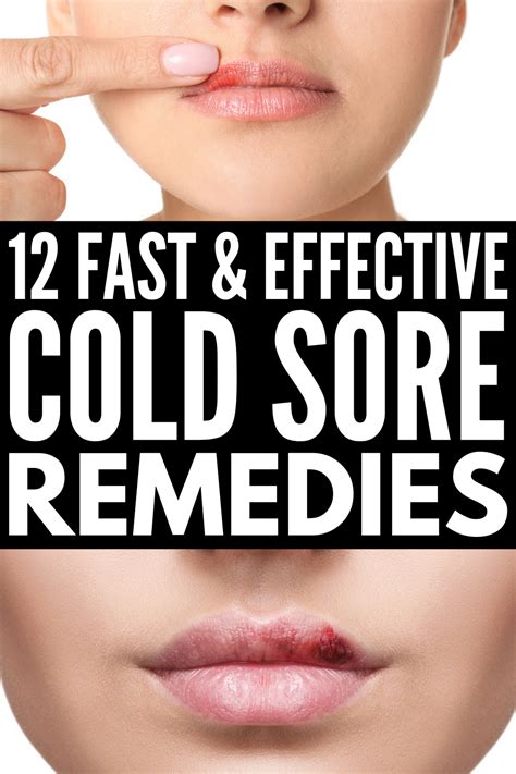 Fast And Effective 12 Natural Cold Sore Remedies That Work Cold