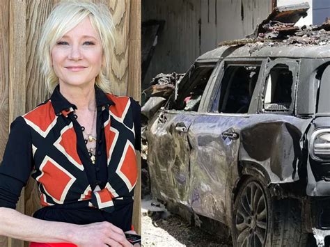 Volcano Fame Anne Heche Suffers Burn Injuries In Car Accident Actress Hospitalized With