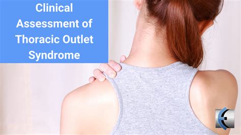 Clinical Assessment Of Thoracic Outlet Syndrome Modern Manual Therapy Blog Manual Therapy