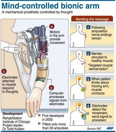Latest Research In Artificial Prosthetic Limbs