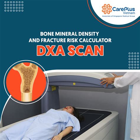 Bone Mineral Density And Fracture Risk Calculator DXA SCAN