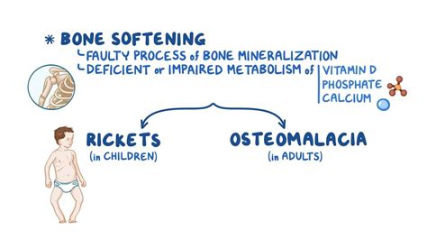 Osteomalacia And Rickets Video Anatomy And Definition Osmosis