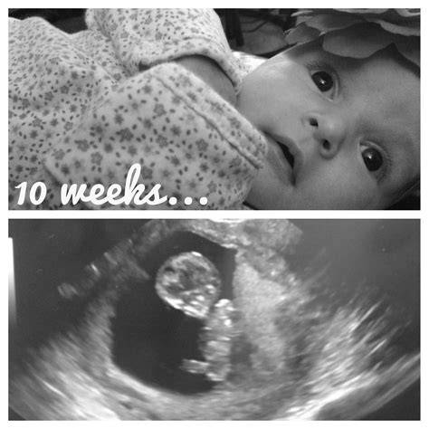 Albums 96 Wallpaper Ultrasound Week By Week Pictures Sharp 112023