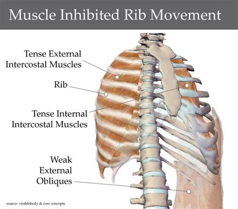 These muscles are able to move the upper limb as they originate at the vertebral column and insert onto. Mal-Aligned Rib Cage: A Case Study - Physiotherapy Articles