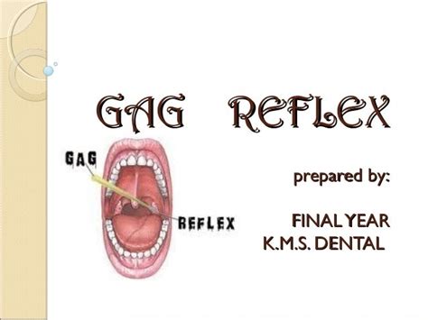 Learn How To Get Rid Of Gag Reflex United States Tutorials Step By