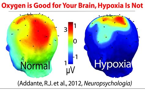 Hypoxia In Flight Aviation Ideas And Discussion