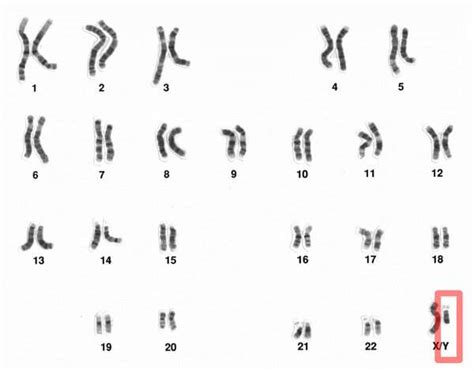 Chromosome Y In Red Next To The Much Larger X Chromosome Credit