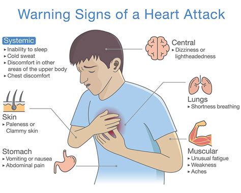 Medical Minute Warning Signs Of A Heart Attack Sandra Rose