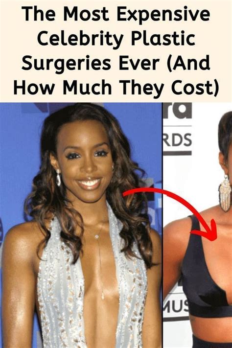 The Most Expensive Celebrity Plastic Surgeries Ever And How Much They Cost In Celebrity