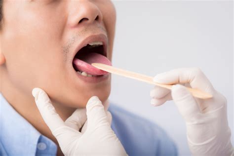 Swollen Taste Buds Causes And Natural Treatment Tips