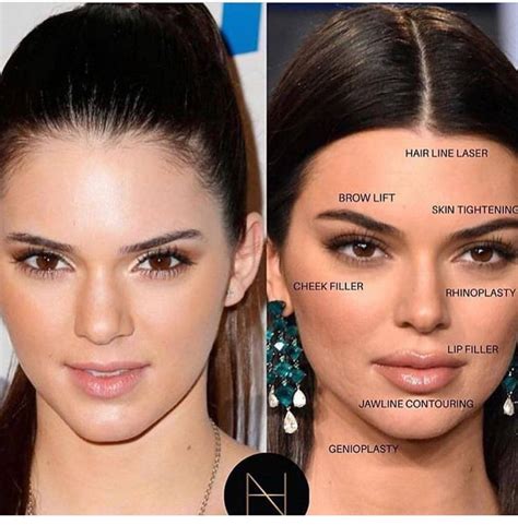 How To Become An Instagram Model Kendal Jenner Before And After