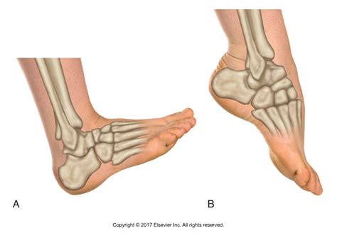 Decreased Ankle Dorsiflexion Is Associated With Dynamic Knee Valgus