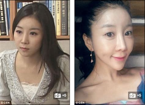 South Korean Reporter Shocks Nation With Drastic Jaw Surgery Did She