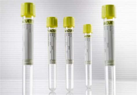 Greiner Bio One Vacuette Urine Ccm Tubes Clinical Specimen Collection