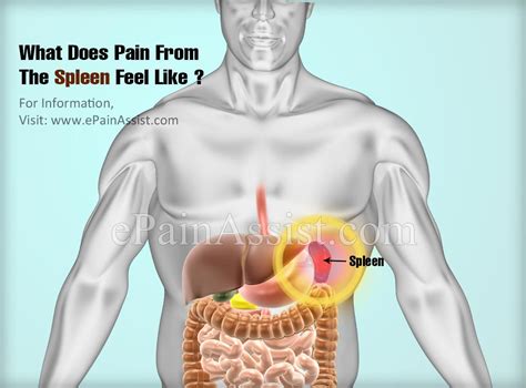 What Does Pain From The Spleen Feel Like And Can A Person Live A Normal