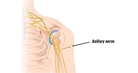 Axillary Nerve Injury Symptoms Causes And Treatment