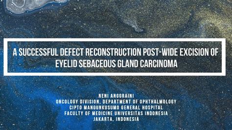 Defect Reconstruction Of Eyelid Sebaceous Gland Carcinoma Youtube
