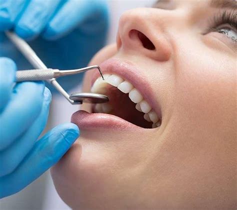Dental Bonding A Briter Smile Cosmetic Dentistry