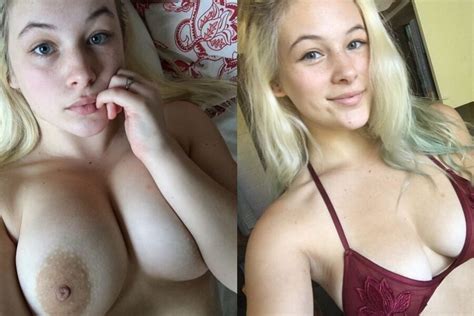 Before And After Bigger Than Expected Tits Nudedworld