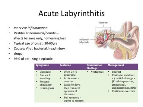 Balance Exercises Balance Exercises Labyrinthitis