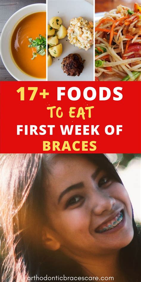 What To Eat With Braces The First Week With List Braces Food Soft Food For Braces Foods