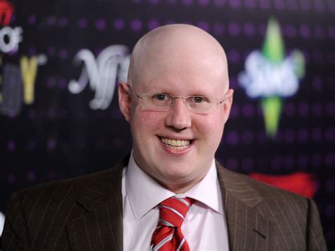 The Great British Bake Offs Matt Lucas Lost His Hair After Being Hit