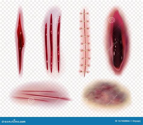Realistic Scars Cuts Wounds Bruises Bruises Blood Stitches Vector