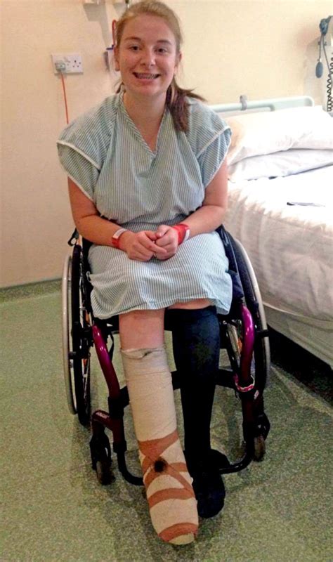 Teenage Girl Pays £5k To Have Leg Amputated After Ingrowing Toenail