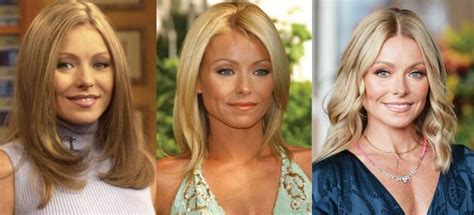 Kelly Ripa Plastic Surgery Before And After Pictures 2024