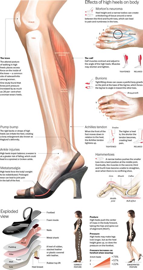 Not So Sexy Facts About High Heels Infographic