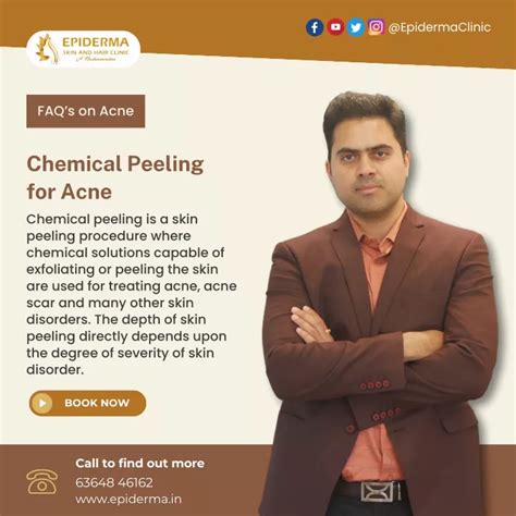 Ppt Chemical Peeling For Acne Best Skin Clinic In Jayanagar