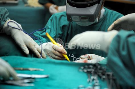 最先端の性転換大国タイ、手術の規制強化へ 写真7枚 国際ニュース：afpbb News