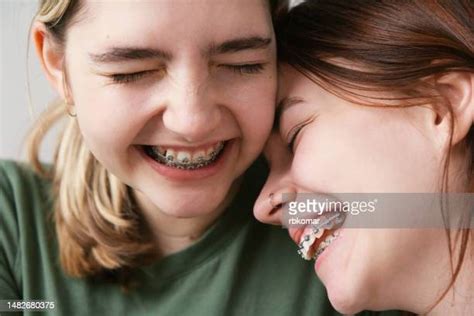 Girlfriend With Braces Photos And Premium High Res Pictures Getty Images