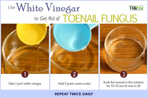 How To Get Rid Of Toenail Fungus Top 10 Home Remedies