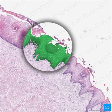 At e17, the morphology and also the location of taste buds changed. Tongue: Anatomy, muscles, neurovasculature and histology ...