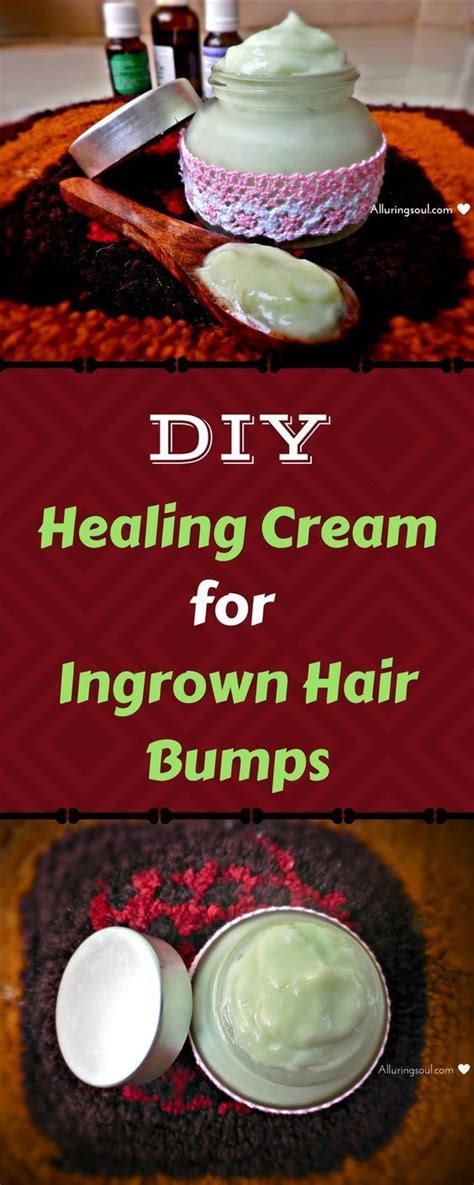 Anyone can get an ingrown hair. Pin on DIY Hygiene