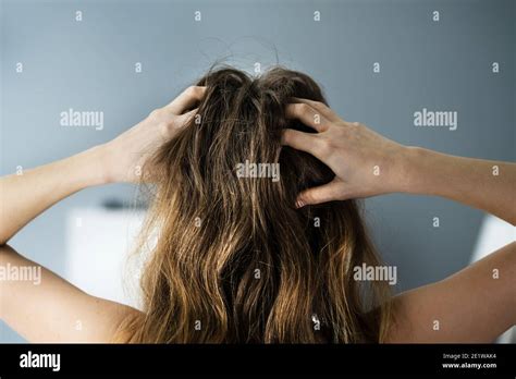 Dry Skin Head Hi Res Stock Photography And Images Alamy