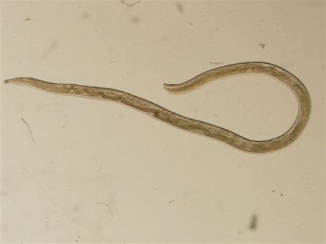 Meet The Menagerie Of Parasites That Can Live In Human Eyes Popular Science Worms Parasite